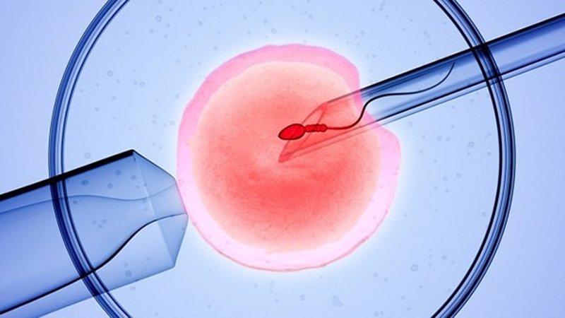 3. Điều kiện về sức khỏe của người được thực hiện phương pháp IVF là gì? 