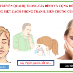 Bệnh quai bị là gì? Hướng dẫn chẩn đoán bệnh quai bị benh-quai-bi